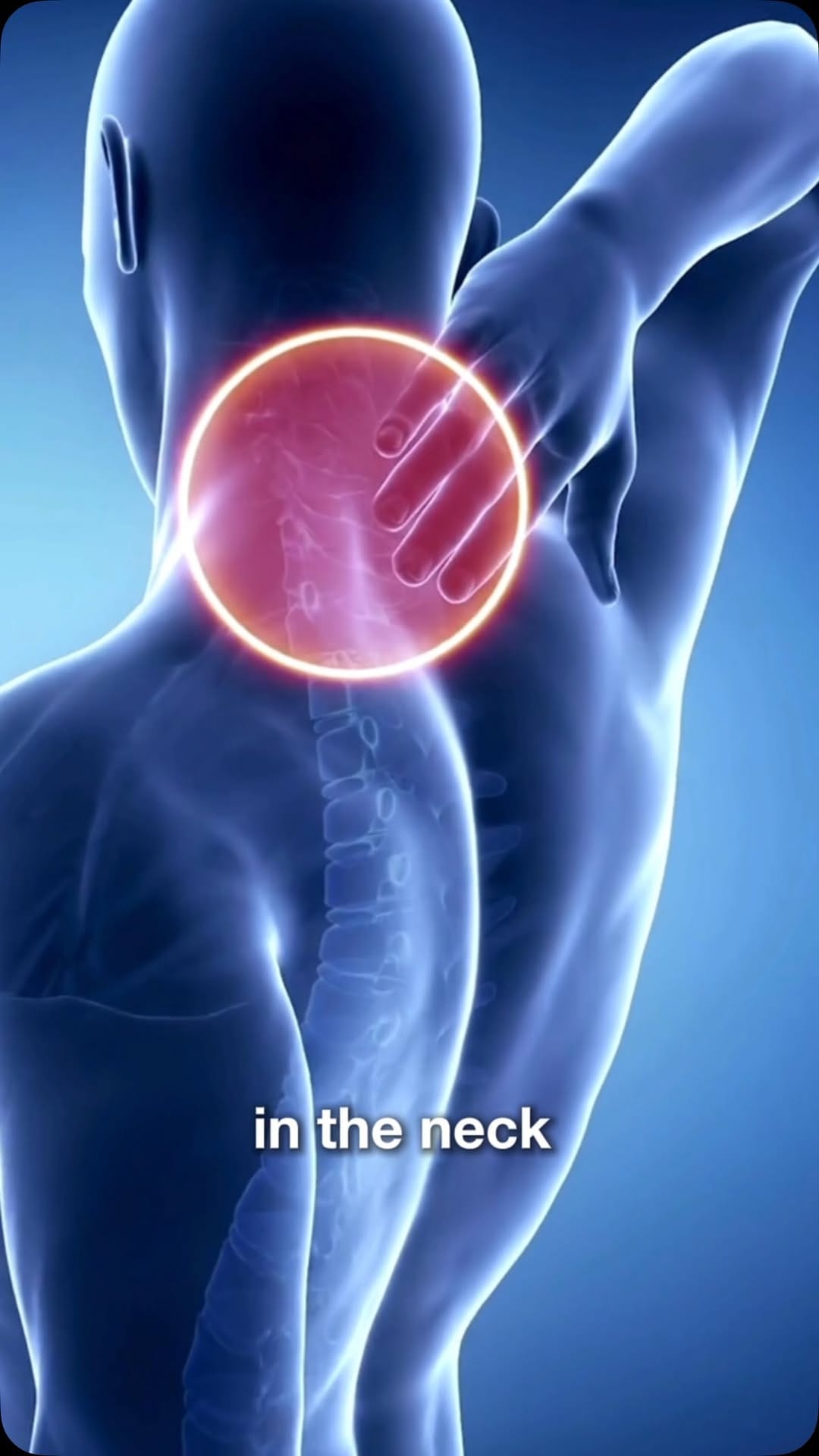 Post 6 by Physio MSK on Instagram (video)