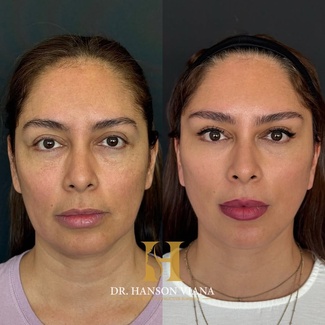 Post 2 by Dr. Erik Hanson Viana on Instagram (carousel)