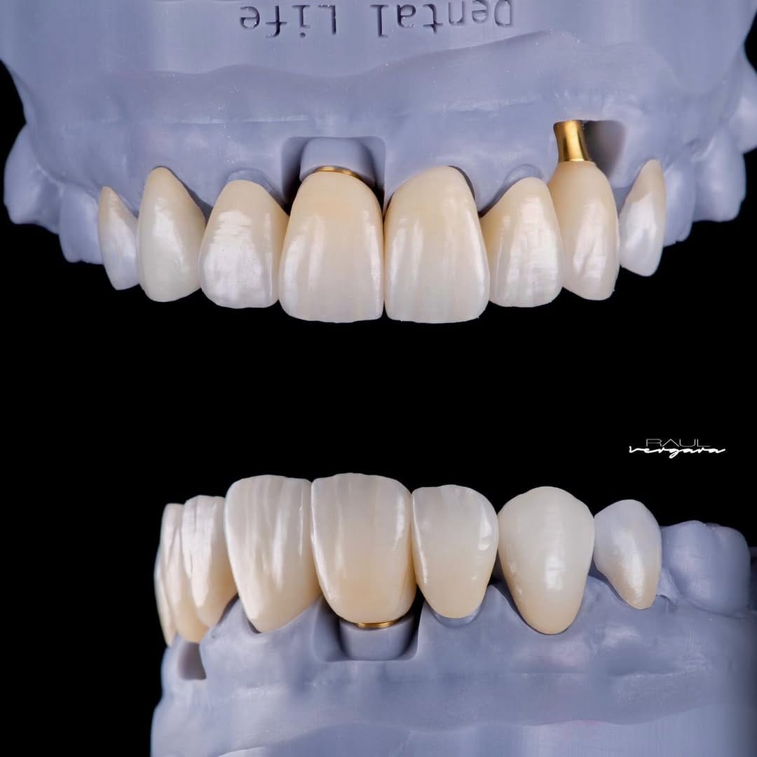 Post 3 by Raúl Vergara Mayorga on Instagram (image)