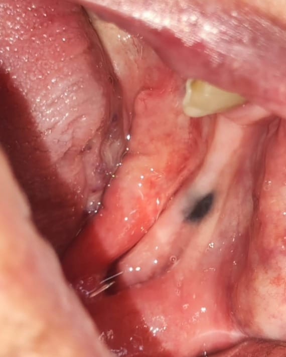 Post 8 by Dr. Edgar Luque •Maxilofacial• on Instagram (carousel)