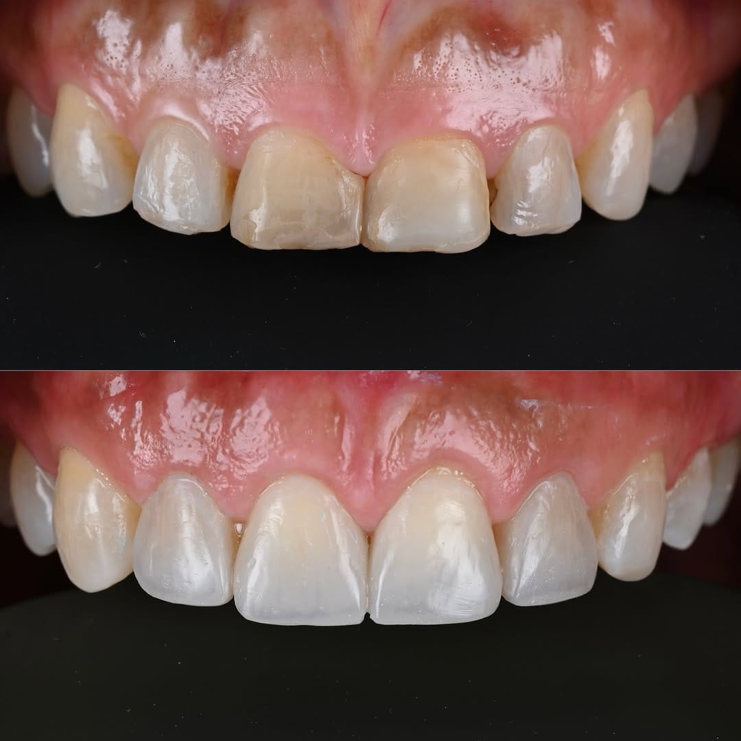 Post 5 by Dr. Joel Alvarez on Instagram (image)