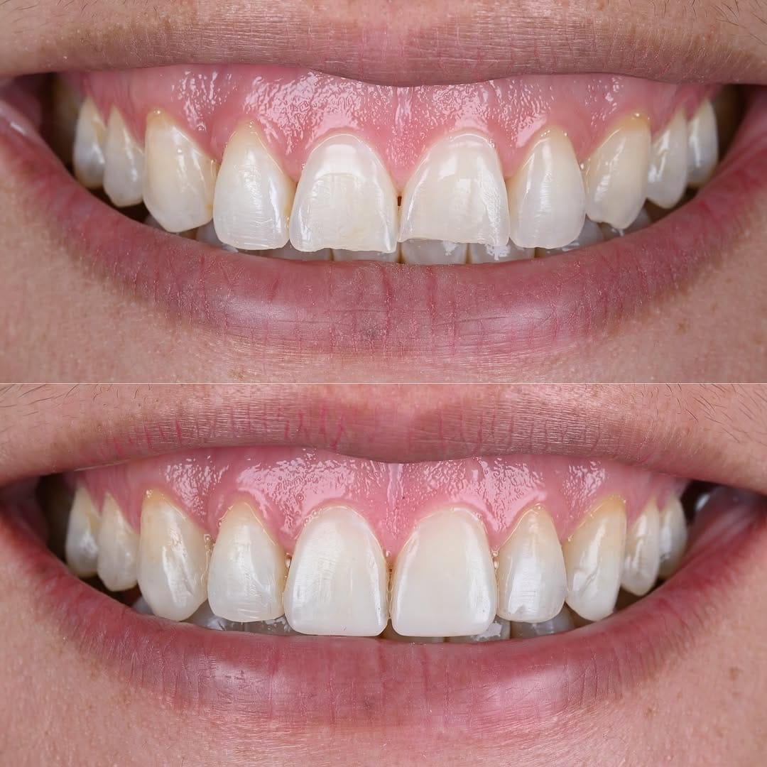 Post 6 by Dr. Joel Alvarez on Instagram (image)