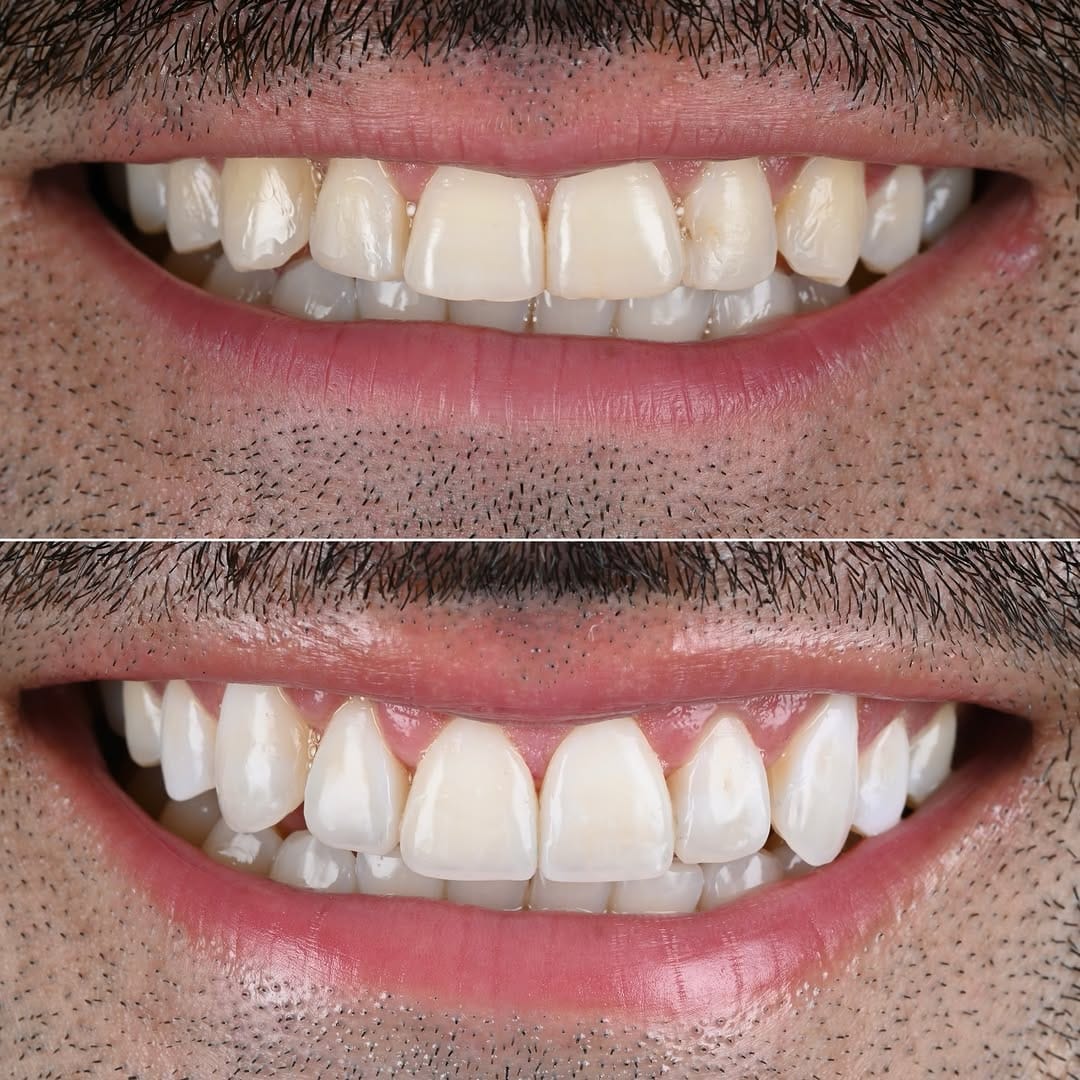 Post 3 by Dr. Joel Alvarez on Instagram (image)