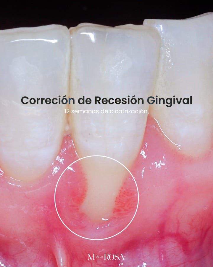 Post 6 by Dr. Manuel de la Rosa on Instagram (carousel)