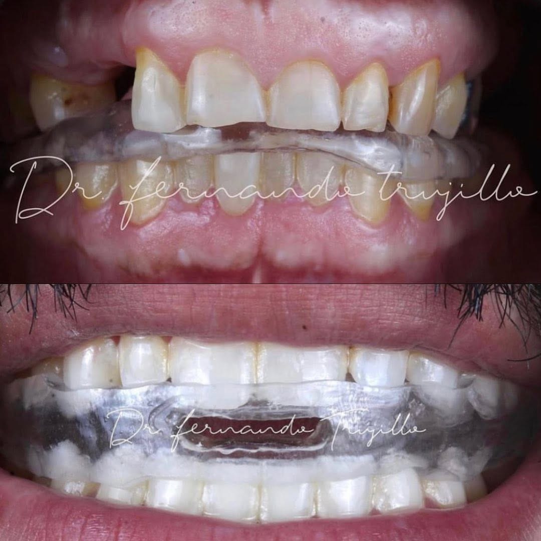 Post 2 by Dentista | Dr Fernando Trujillo on Instagram (image)