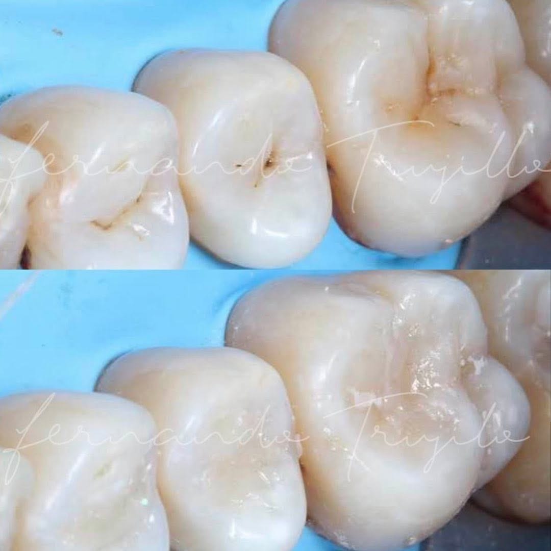 Post 4 by Dentista | Dr Fernando Trujillo on Instagram (image)