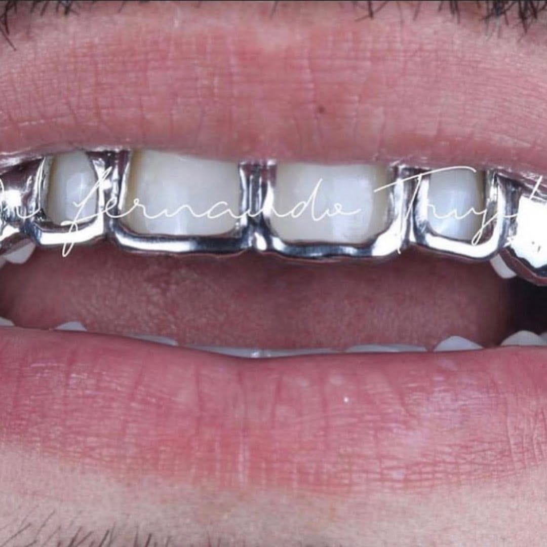 Post 9 by Dentista | Dr Fernando Trujillo on Instagram (image)