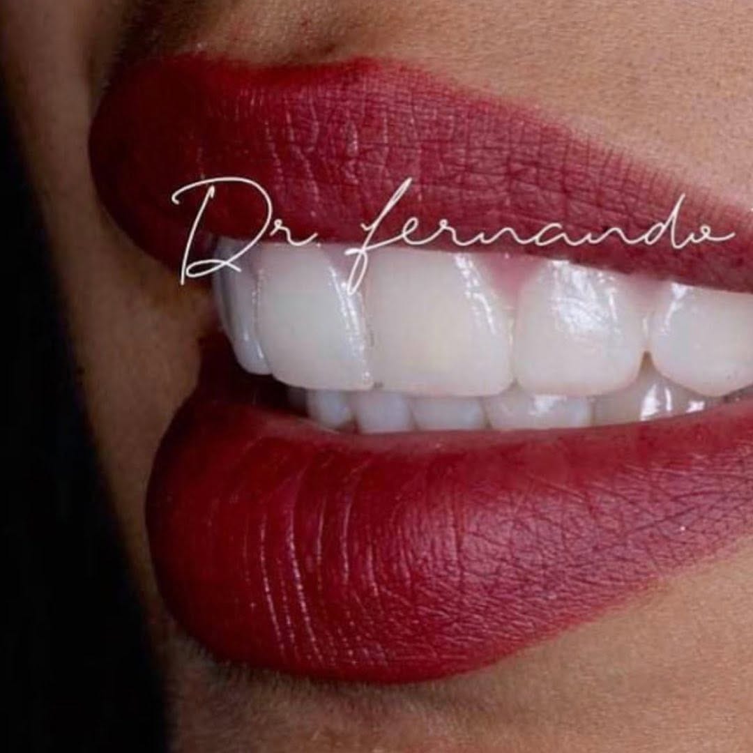 Post 3 by Dentista | Dr Fernando Trujillo on Instagram (image)