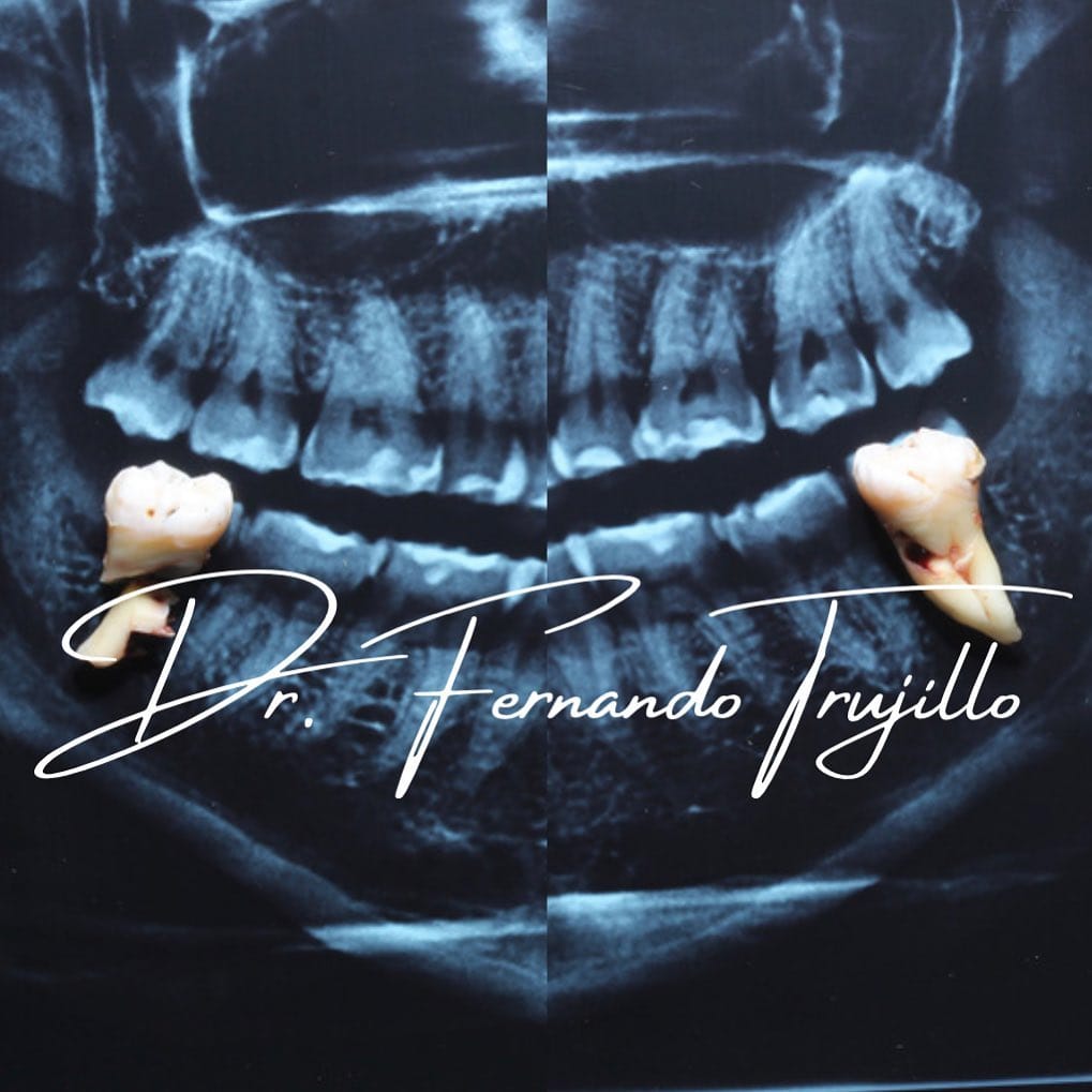Post 8 by Dentista | Dr Fernando Trujillo on Instagram (image)