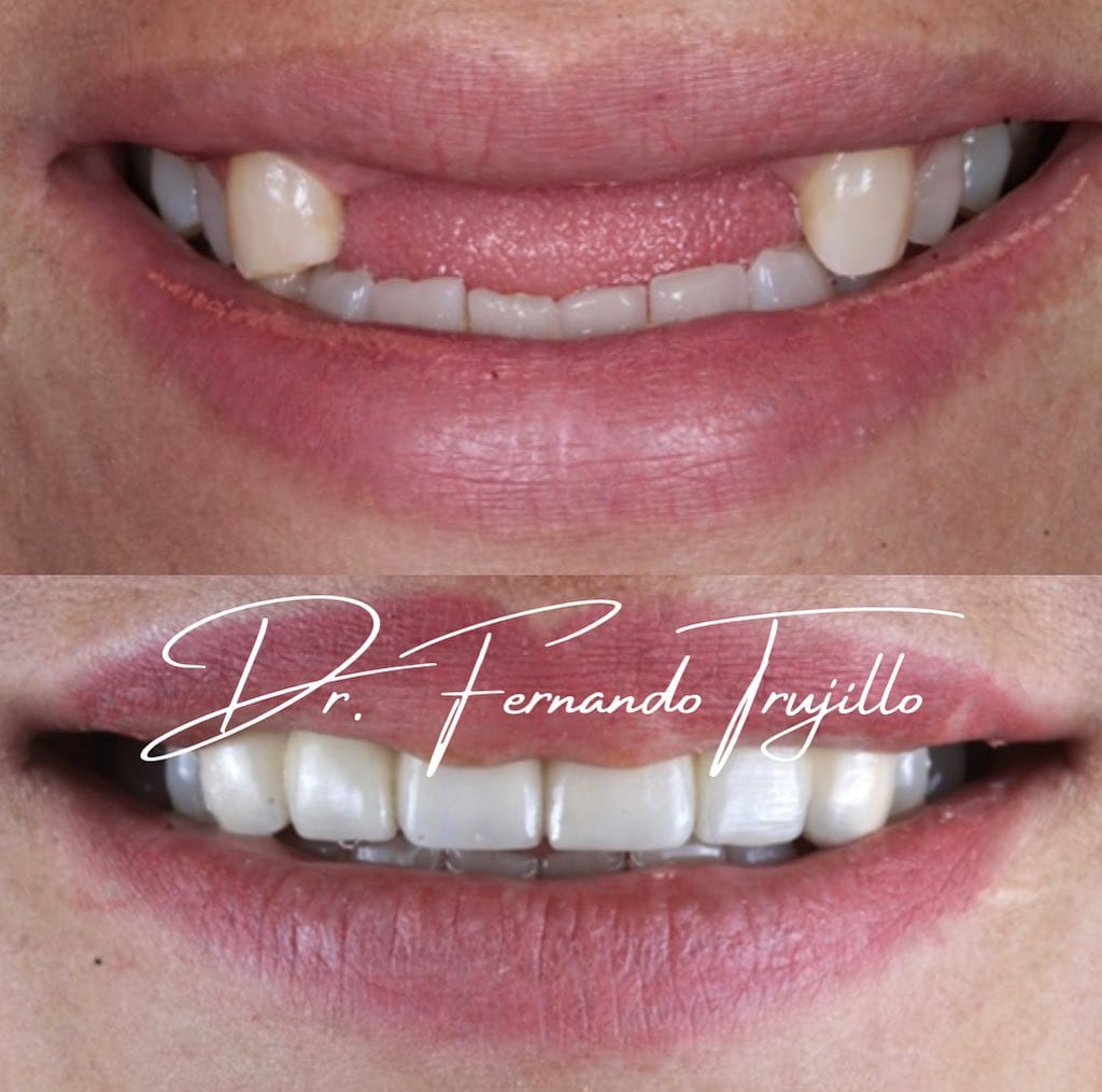 Post 10 by Dentista | Dr Fernando Trujillo on Instagram (image)