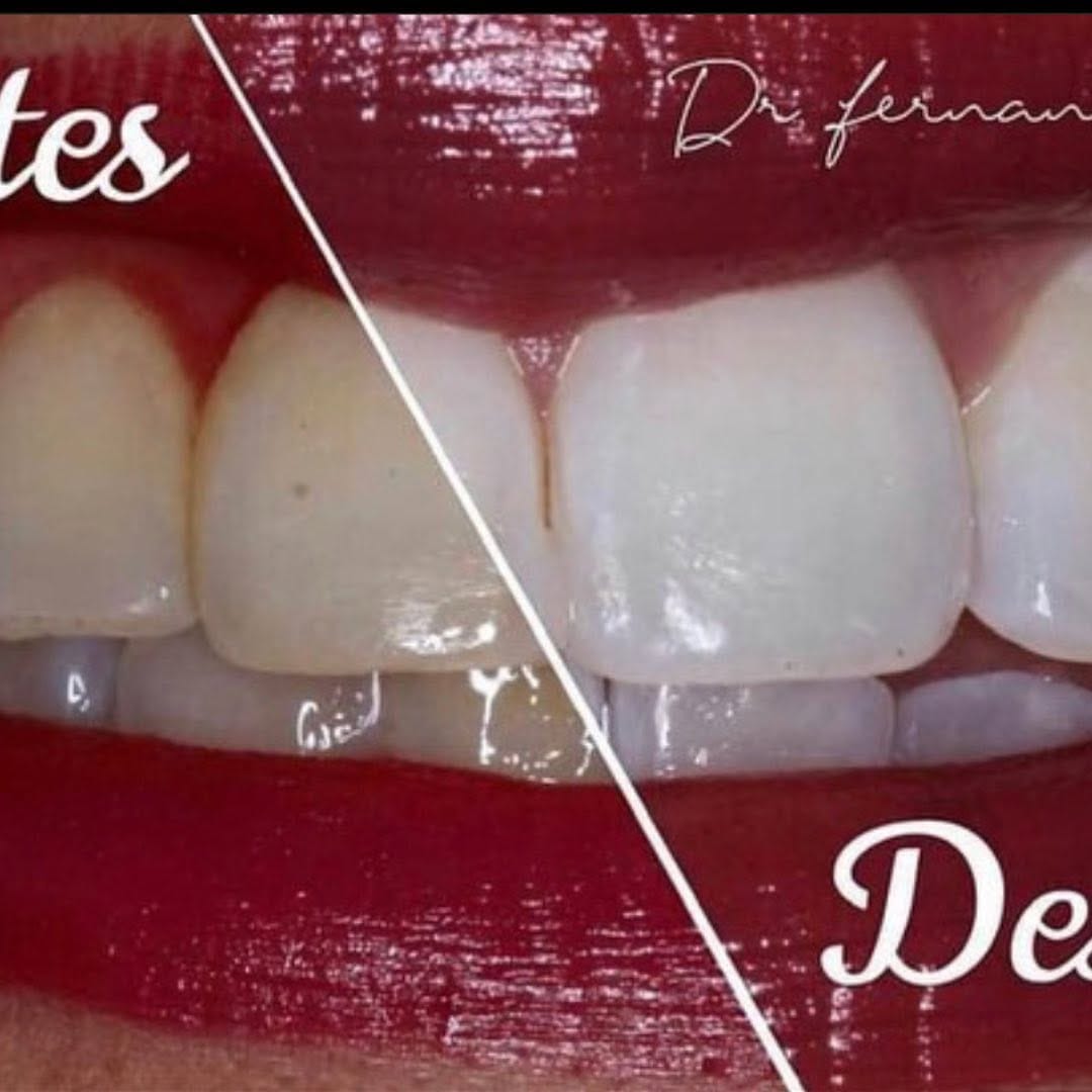 Post 5 by Dentista | Dr Fernando Trujillo on Instagram (image)