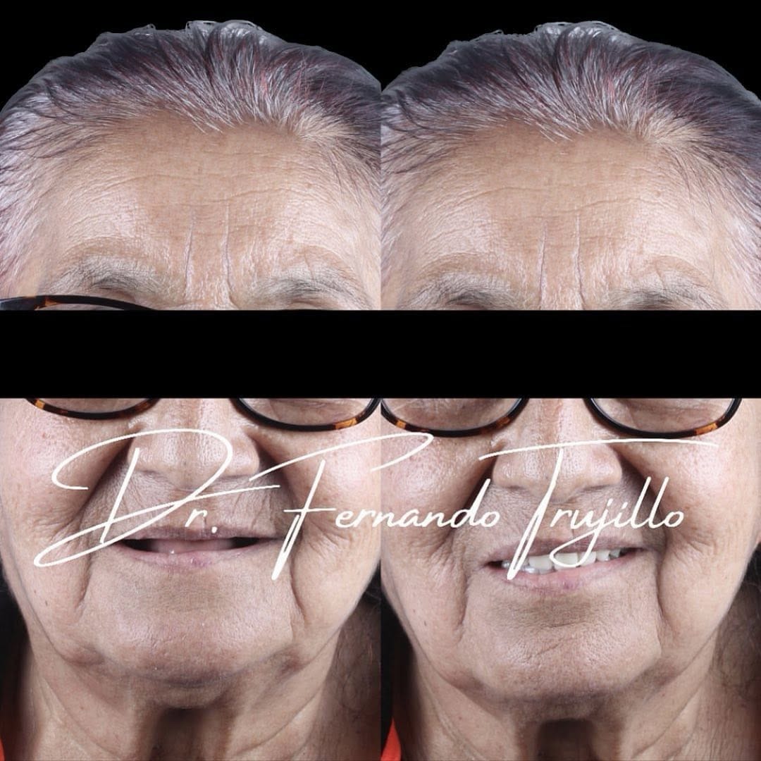 Post 1 by Dentista | Dr Fernando Trujillo on Instagram (image)