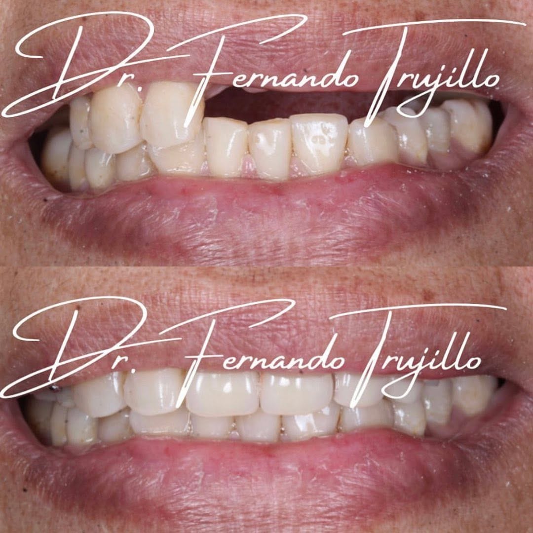 Post 7 by Dentista | Dr Fernando Trujillo on Instagram (image)