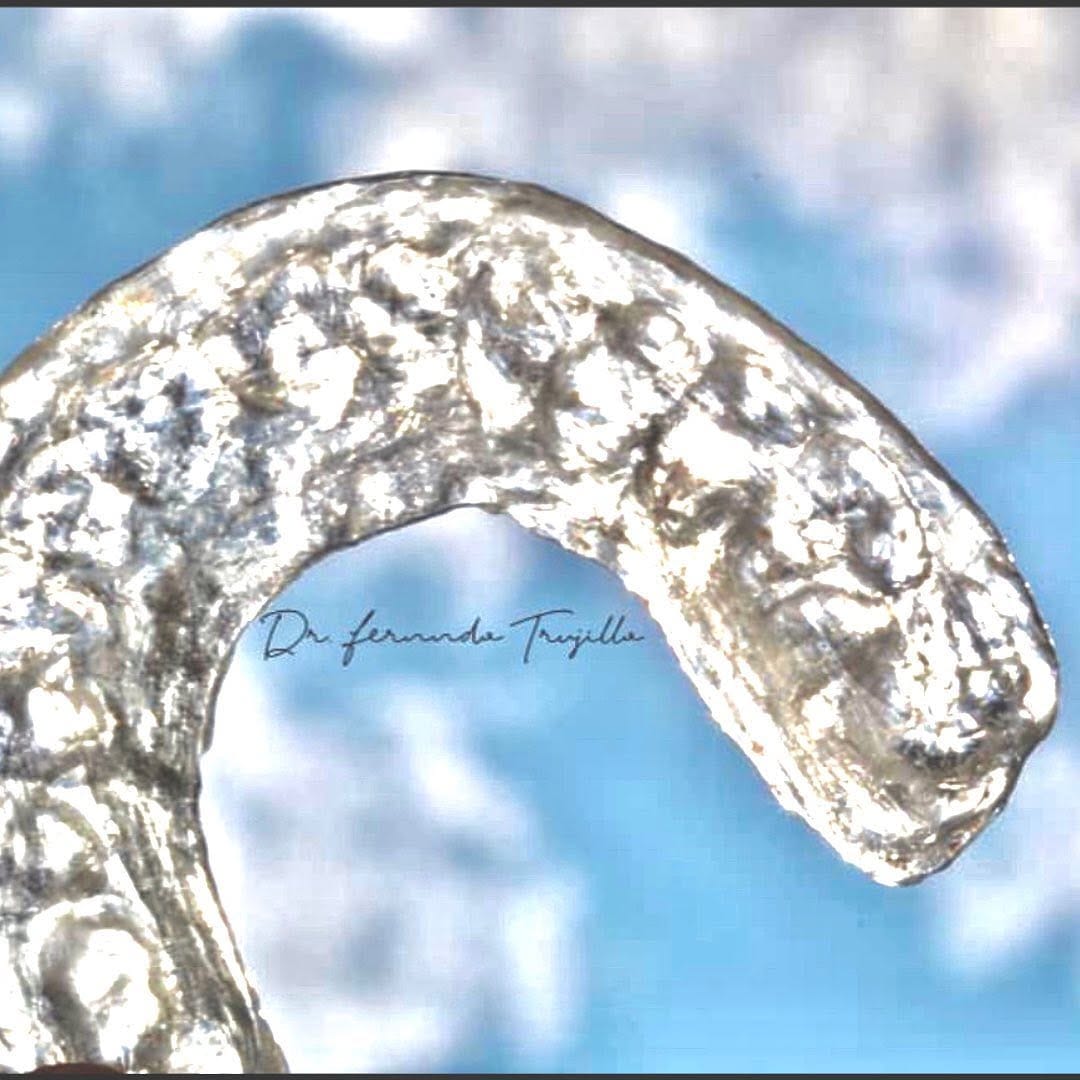 Post 6 by Dentista | Dr Fernando Trujillo on Instagram (image)