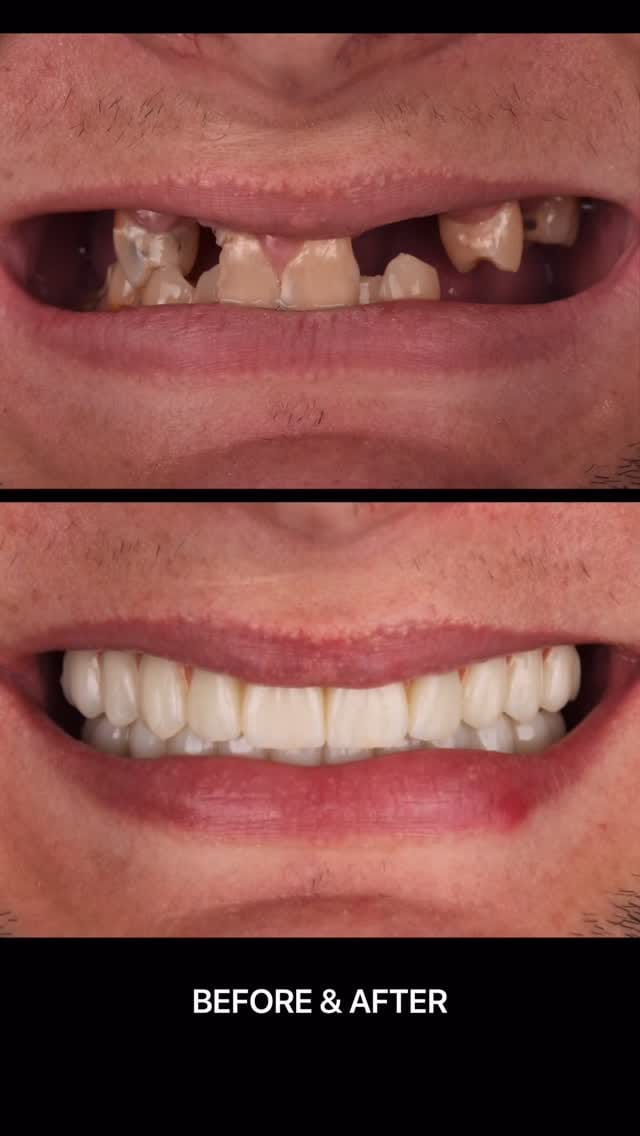 Post 8 by Dr. Omar Lugo on Instagram (video)
