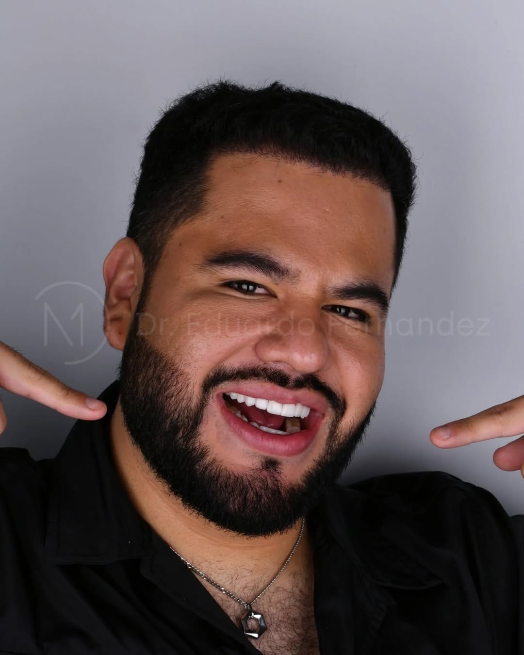Post 4 by Dr. Eduardo Fernandez  | Diseño de Sonrisa on Instagram (image)