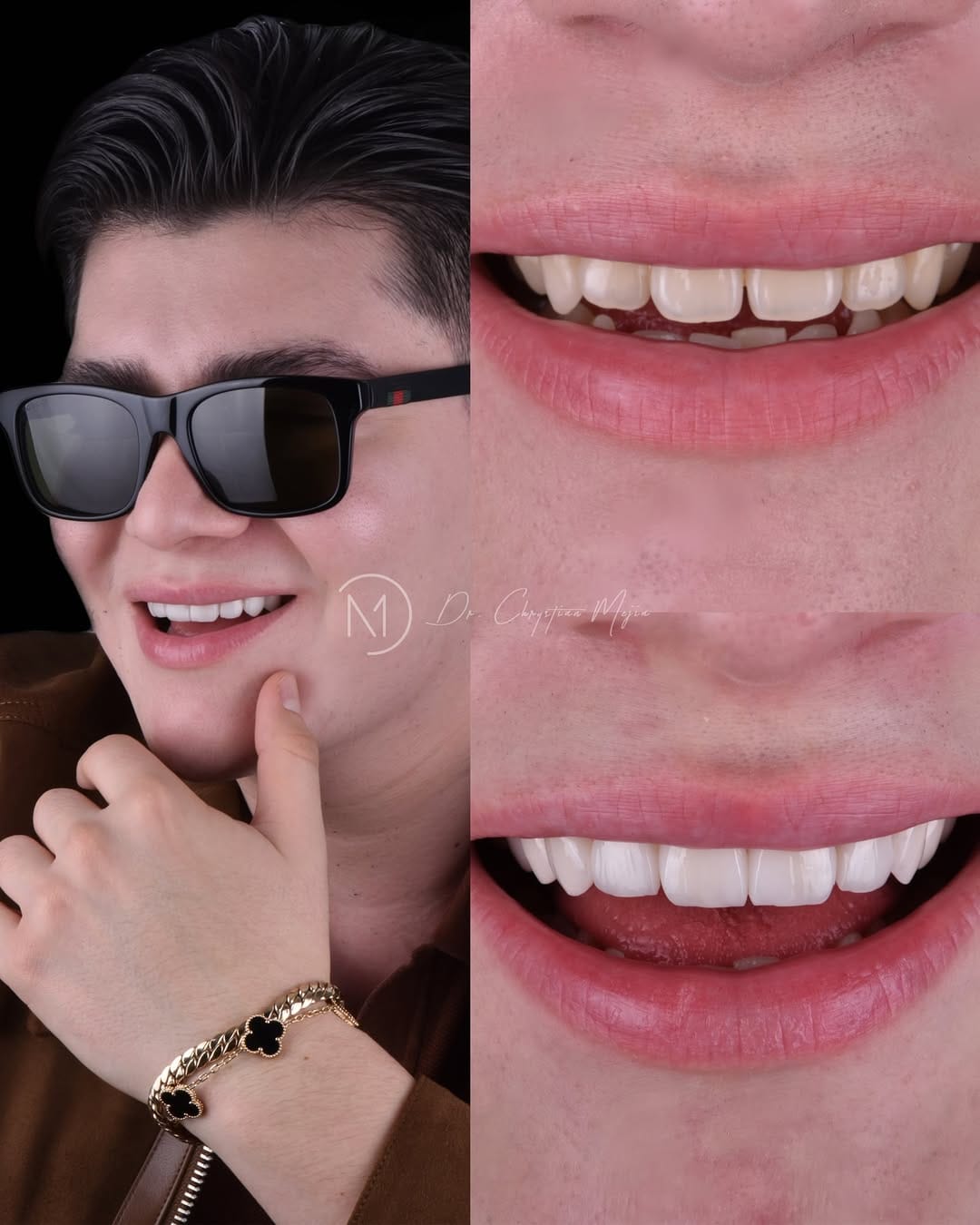 Post 10 by Dr. Eduardo Fernandez  | Diseño de Sonrisa on Instagram (carousel)