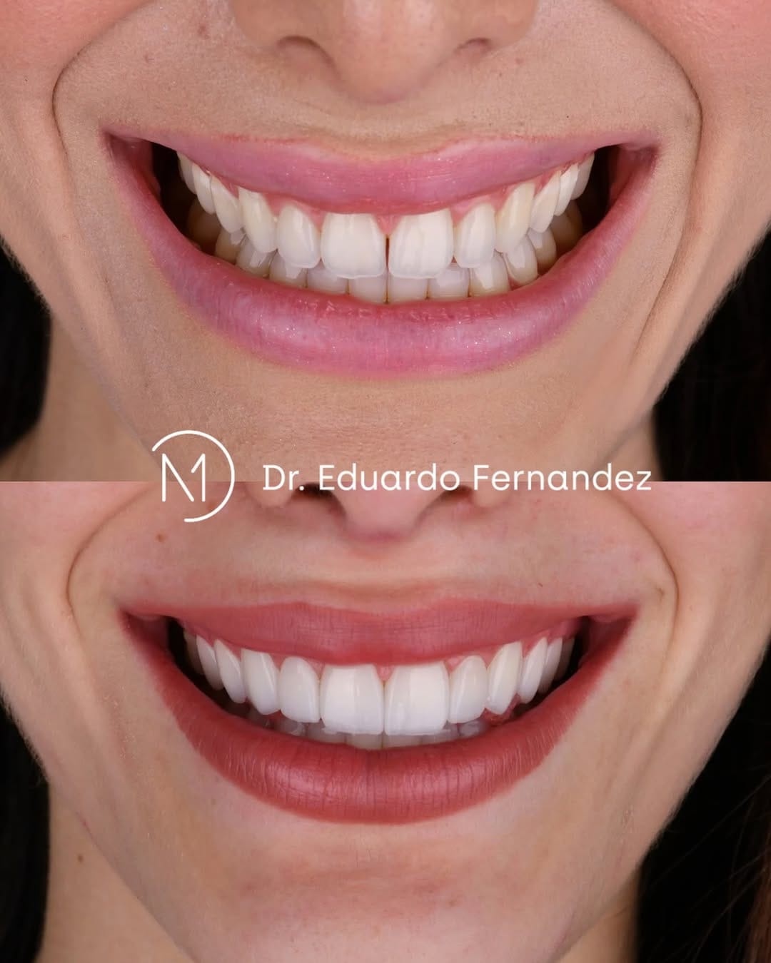 Post 5 by Dr. Eduardo Fernandez  | Diseño de Sonrisa on Instagram (image)