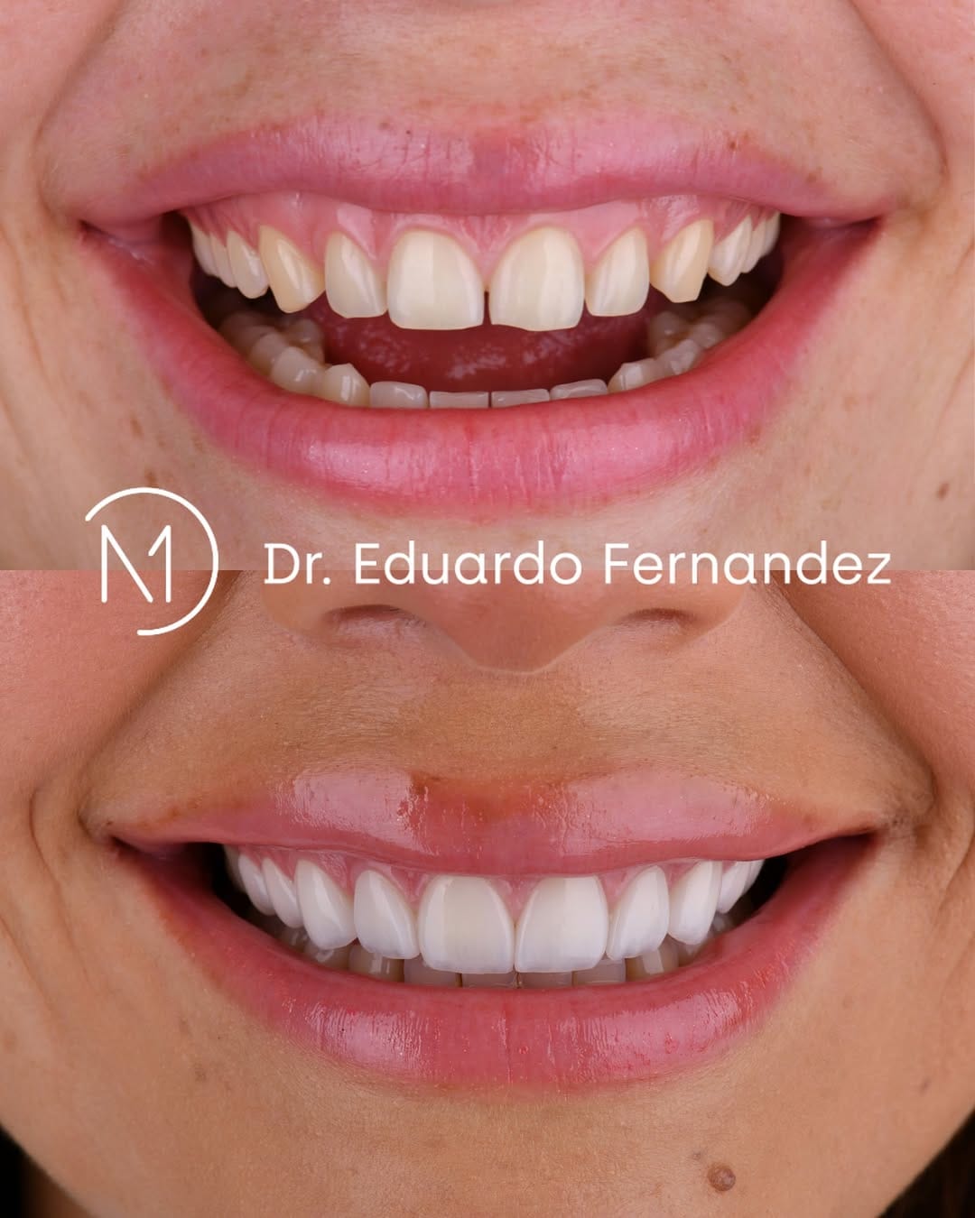 Post 2 by Dr. Eduardo Fernandez  | Diseño de Sonrisa on Instagram (image)
