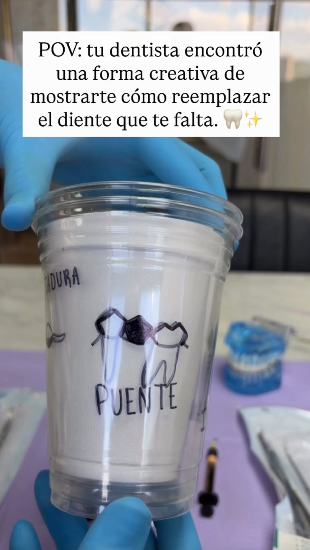 Post 9 by Dr Benavides | Carillas de Porcelana on Instagram (video)