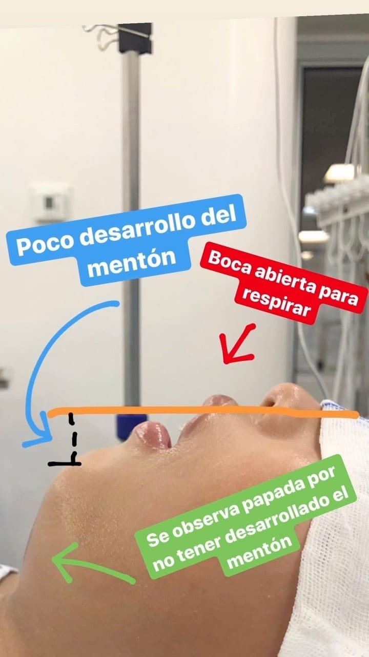 Post 9 by Dr. Sueño - Dr. Javier Nagore on Instagram (video)