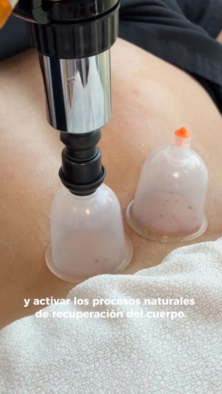 Post 4 by Nuevo Polanco Medical Center on Instagram (video)