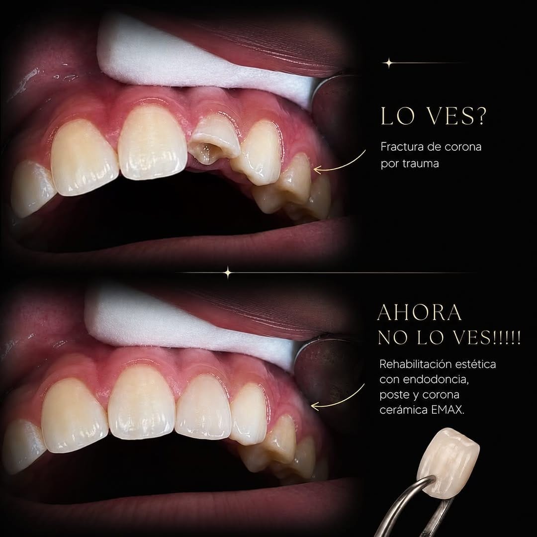 Post 7 by Nuevo Polanco Medical Center on Instagram (image)