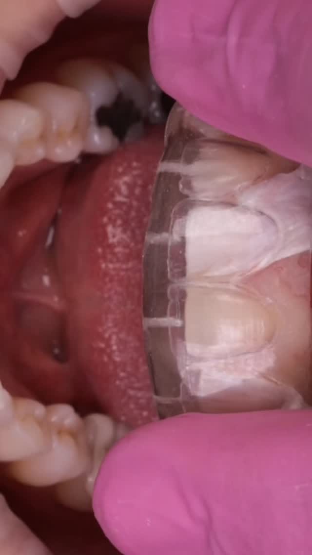 Post 7 by Ernesto Enrique Diaz Guzman on Instagram (video)