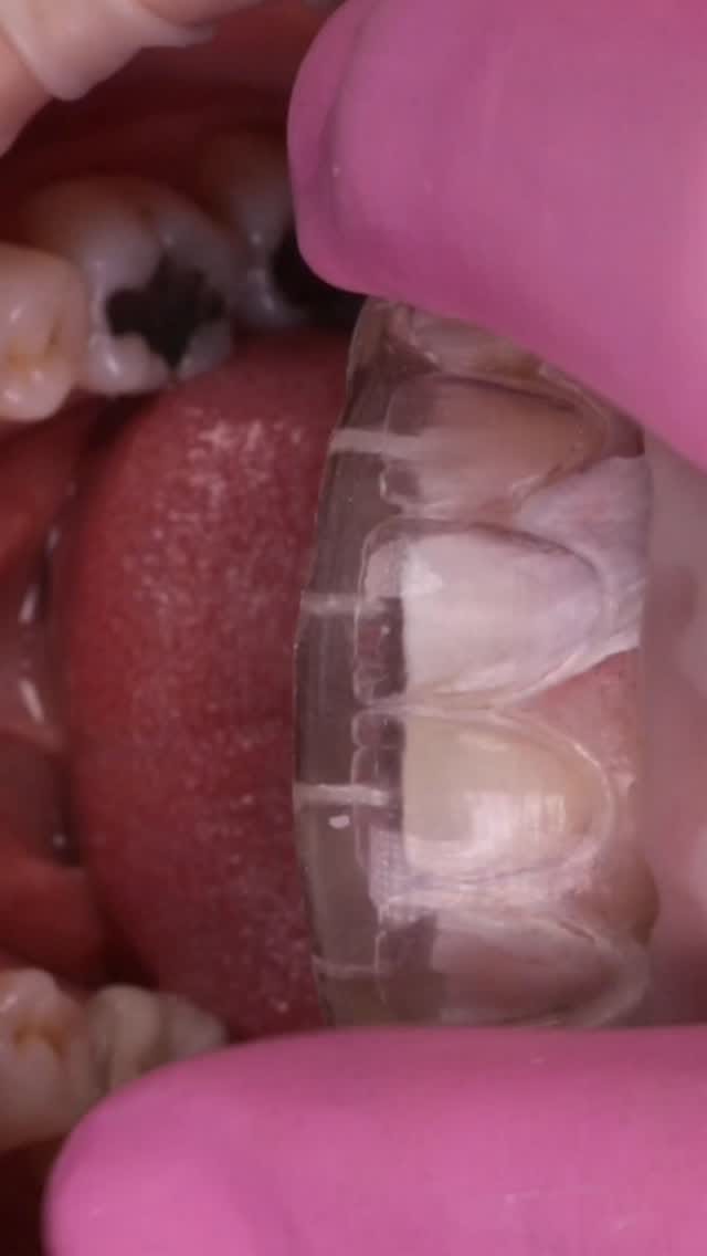 Post 5 by Ernesto Enrique Diaz Guzman on Instagram (video)