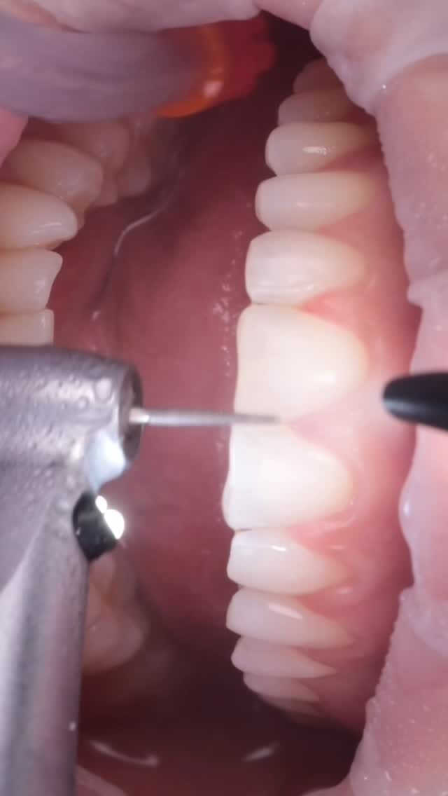 Post 8 by Ernesto Enrique Diaz Guzman on Instagram (video)