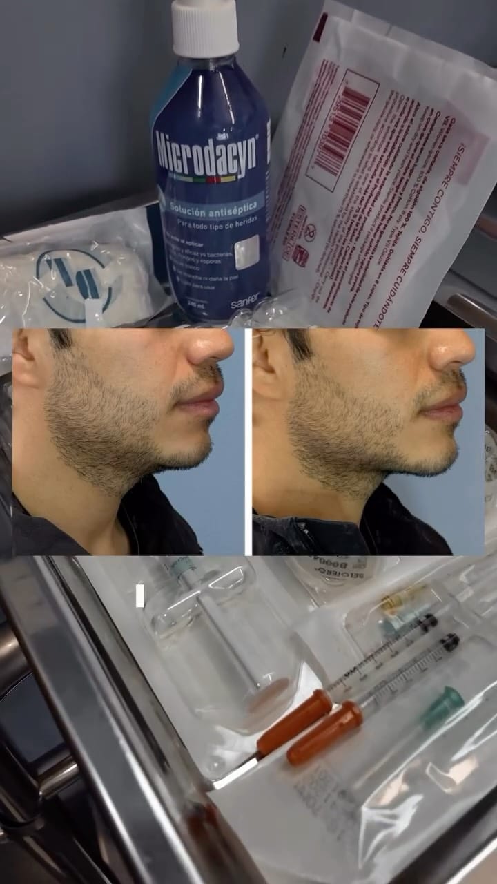 Post 5 by Omar Esquerra on Instagram (video)