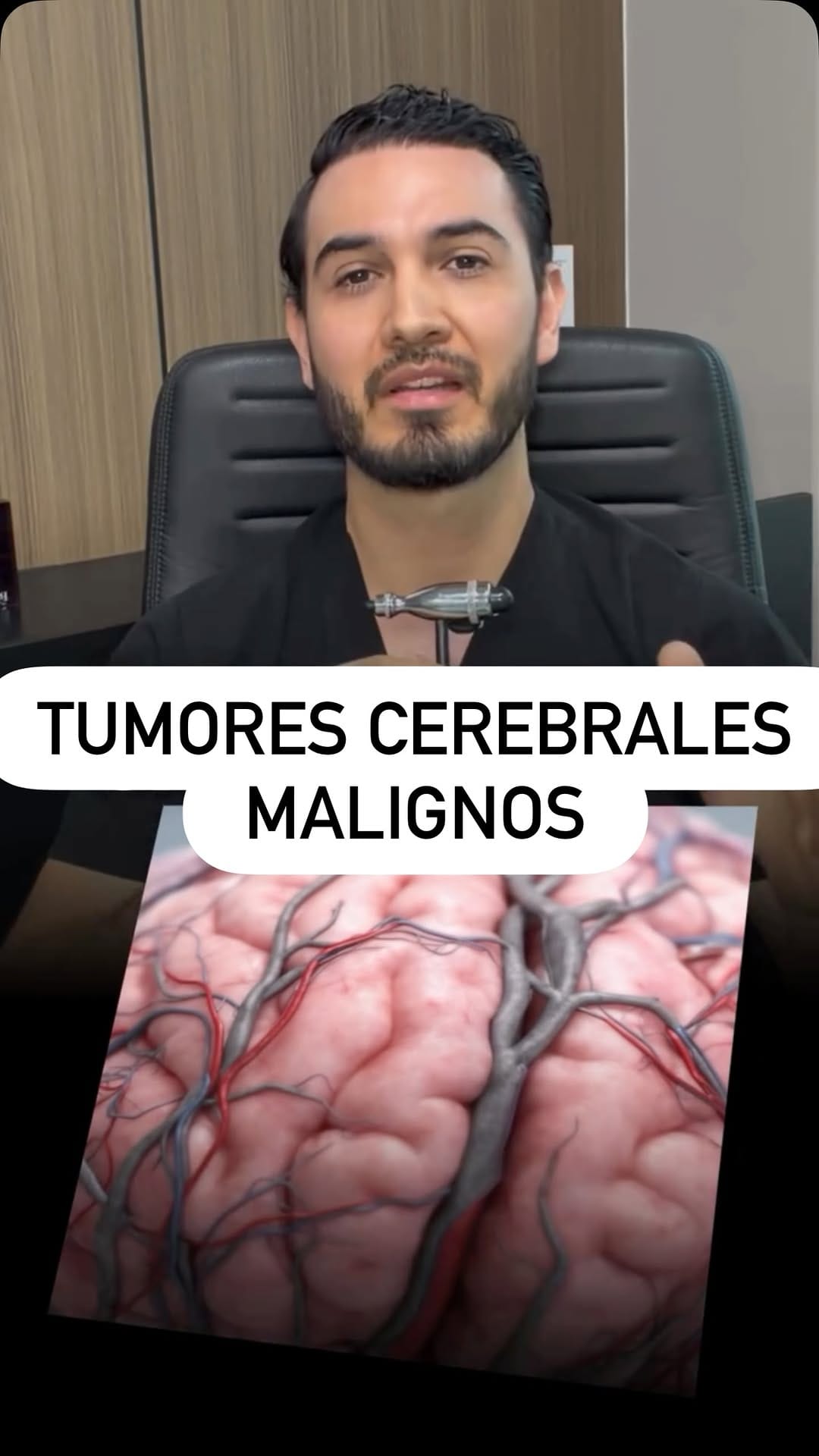 Post 6 by Dr. Carlos Estrella | Neurocirujano Guadalajara on Instagram (video)