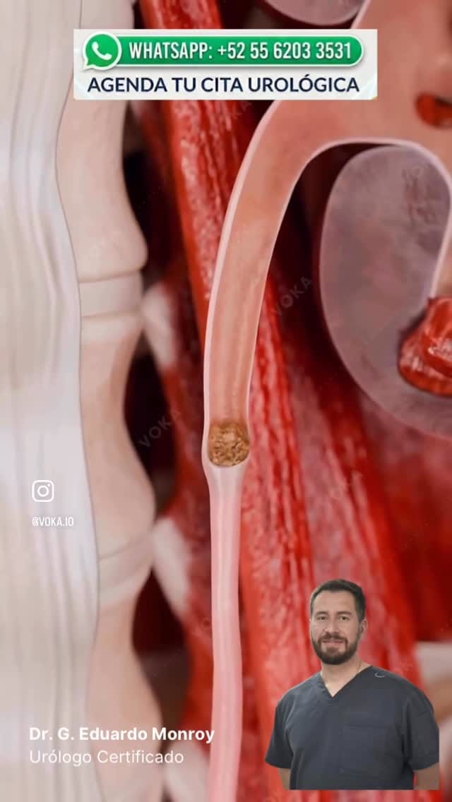 Post 1 by Dr. Eduardo Monroy Bolaños on Instagram (video)
