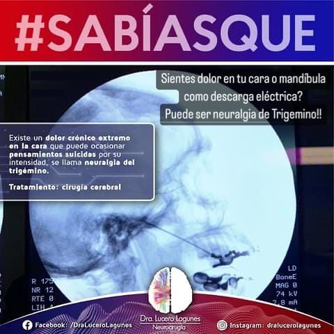 Post 5 by Dra. Lucero Lagunes on Instagram (image)