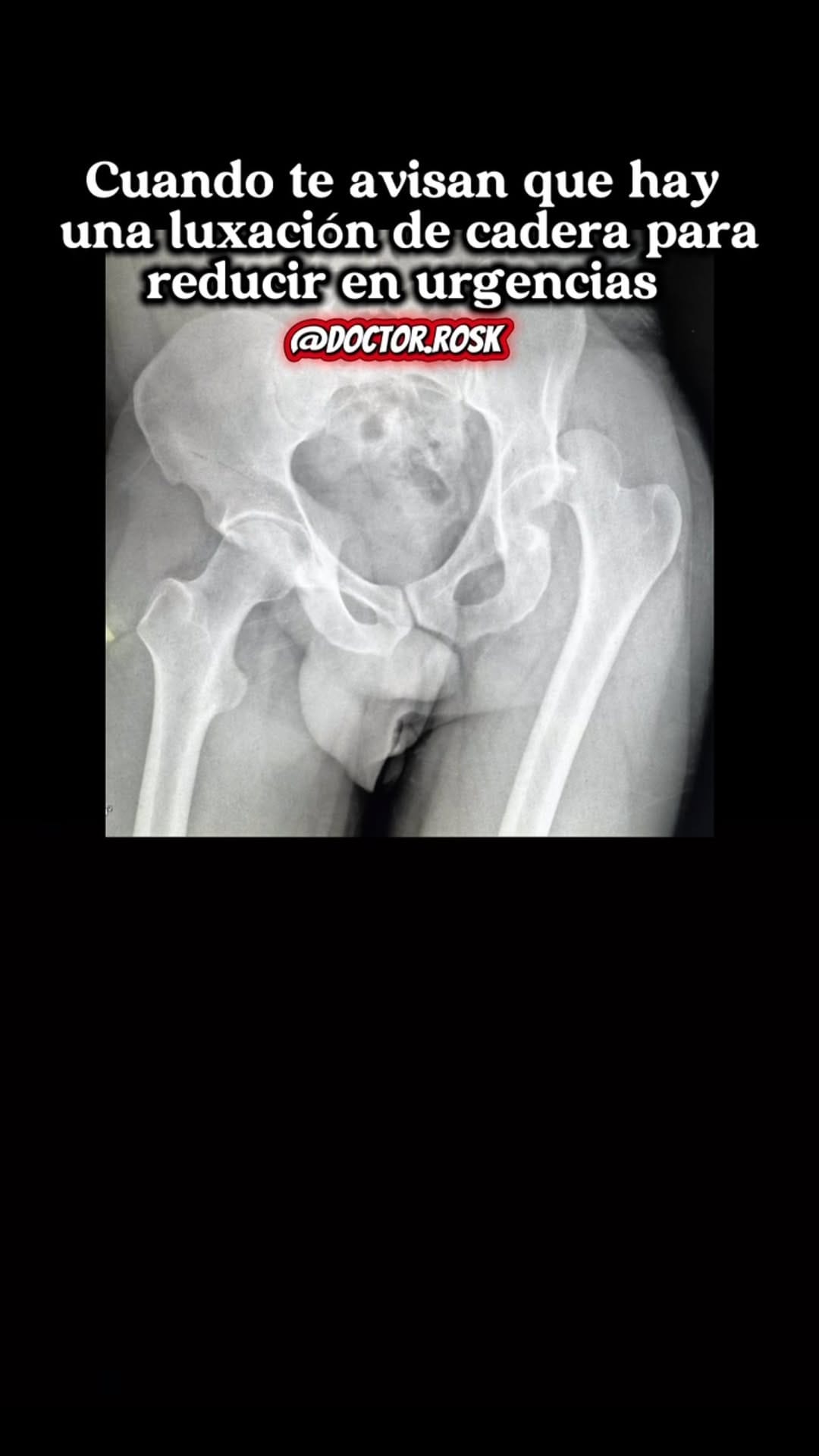 Post 4 by DR. ROSK (DR. KEVIN ROBLES) on Instagram (video)