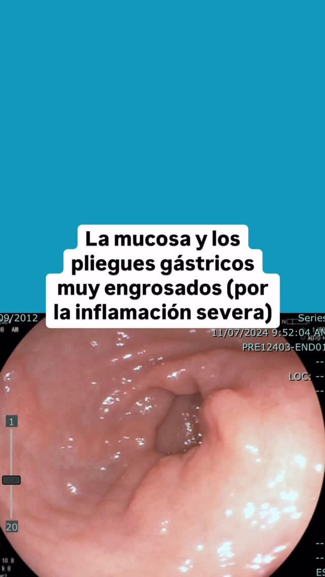 Post 4 by Dr Jorge Adonaí Valdez on Instagram (video)