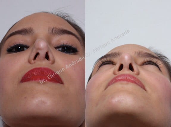 Post 10 by Dr. Enrique Andrade on Instagram (image)