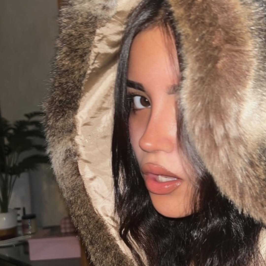 Post 9 by Dr. Lorenzo Lizárraga | Rinoplastia ultrasónica on Instagram (carousel)