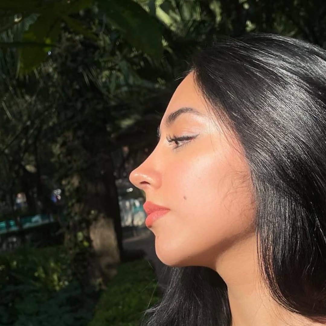 Post 8 by Dr. Lorenzo Lizárraga | Rinoplastia ultrasónica on Instagram (carousel)