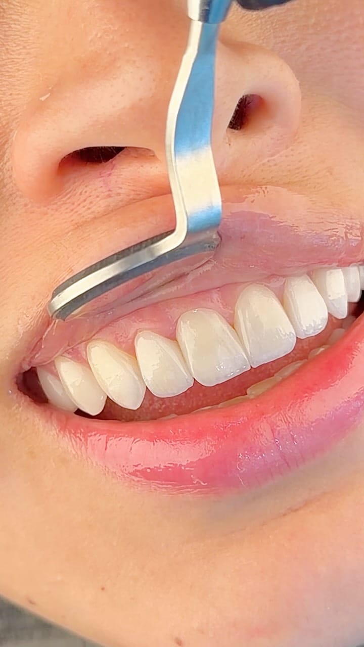 Post 1 by Dr. Michael Martinez on Instagram (video)