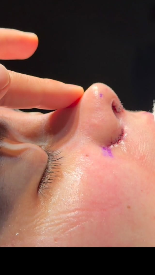 Post 9 by Dr. José Pablo Busto Ruano on Instagram (video)