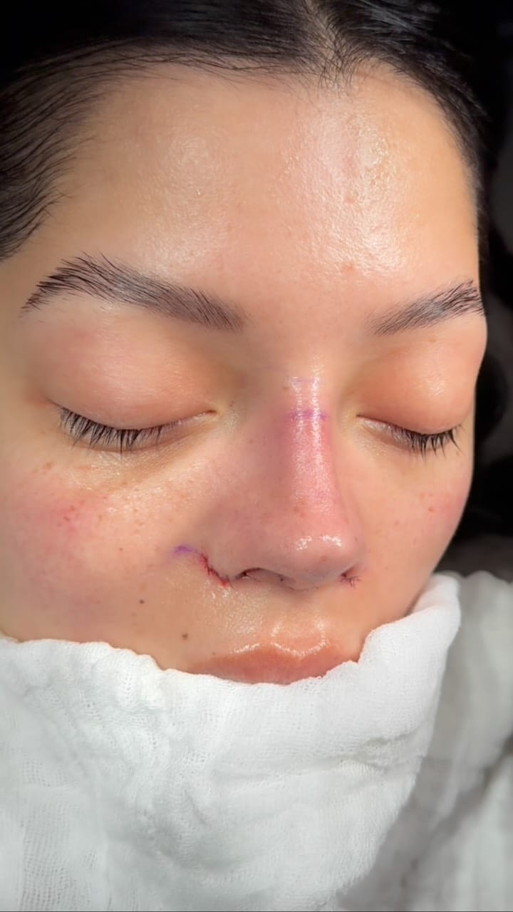 Post 2 by Dr. José Pablo Busto Ruano on Instagram (video)