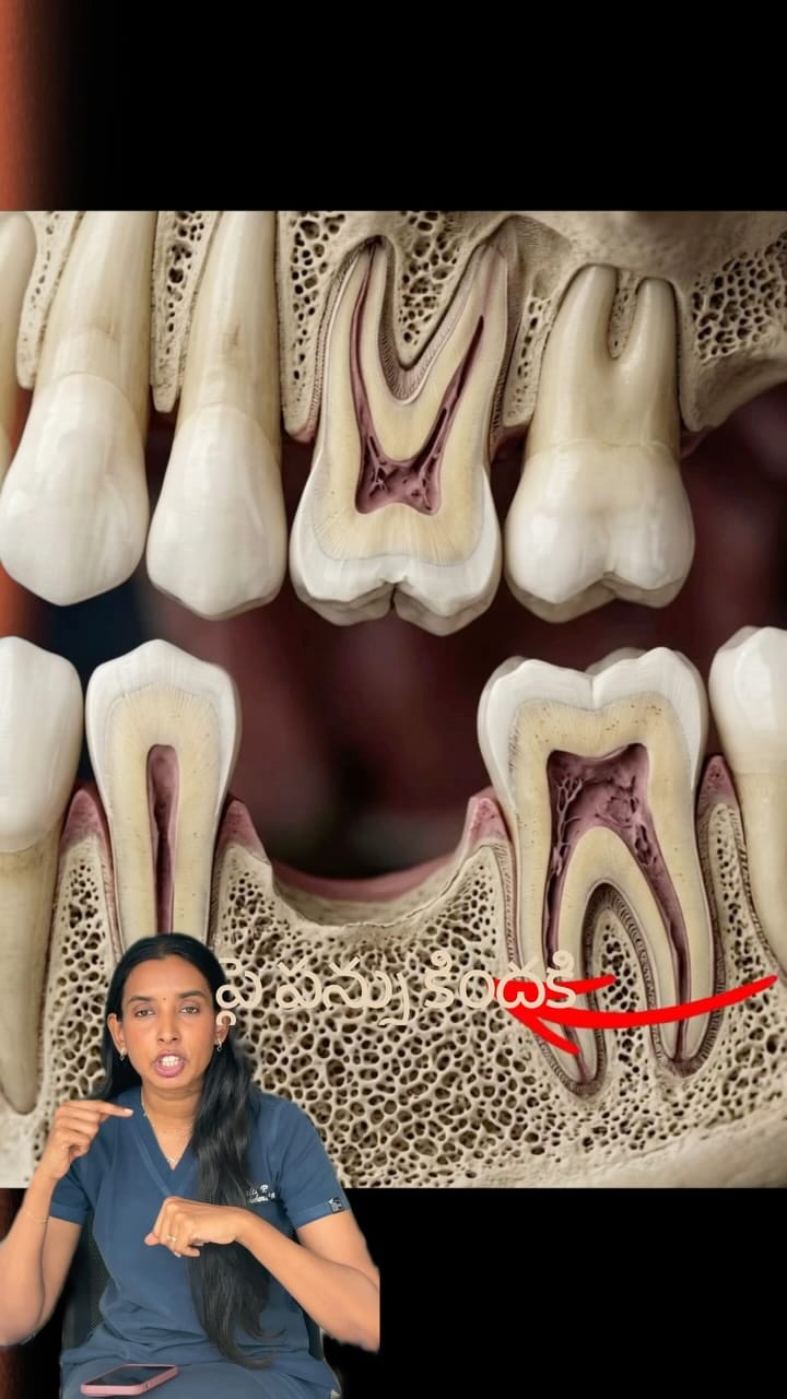 Post 9 by Sattva Dental | Kakinada | Vizag on Instagram (video)