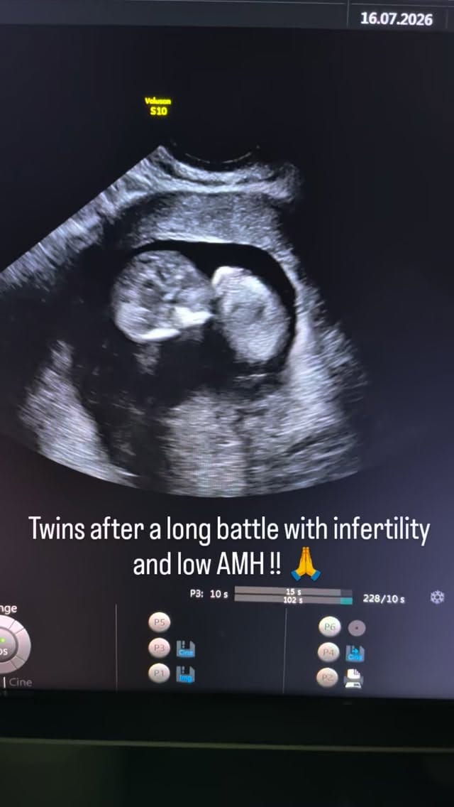 Post 4 by Delhi Ivf on Instagram (video)