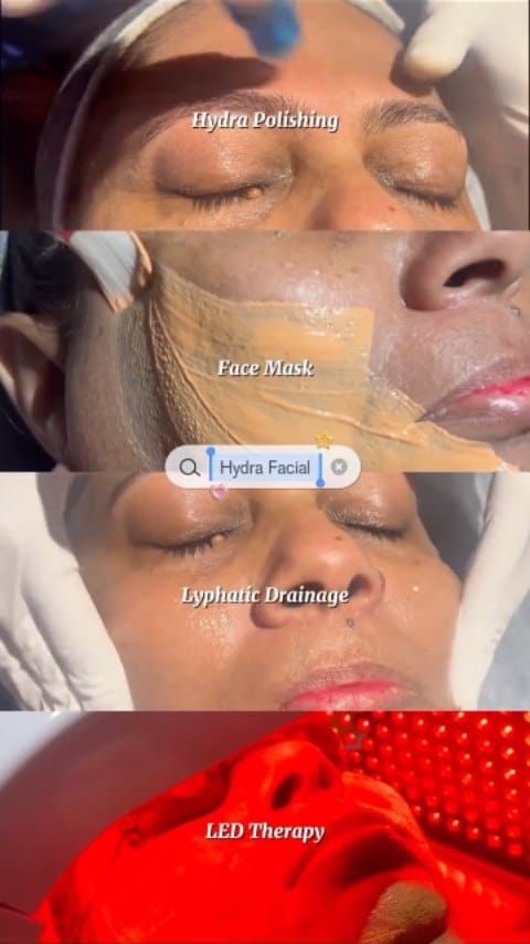 Post 1 by Dr. Deepam Shah | Dermatologist | Hair Transplant Surgeon on Instagram (video)