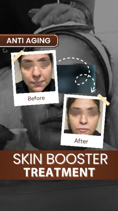 Post 9 by Dr. Deepam Shah | Dermatologist | Hair Transplant Surgeon on Instagram (video)