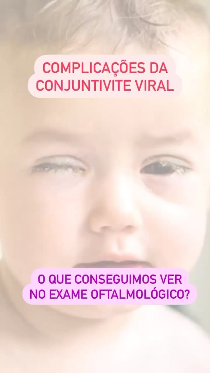 Post 5 by Oftalmopediatria em Casa on Instagram (video)