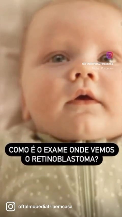 Post 8 by Oftalmopediatria em Casa on Instagram (video)