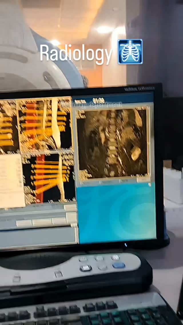 Post 1 by Radiologyyy on Instagram (video)