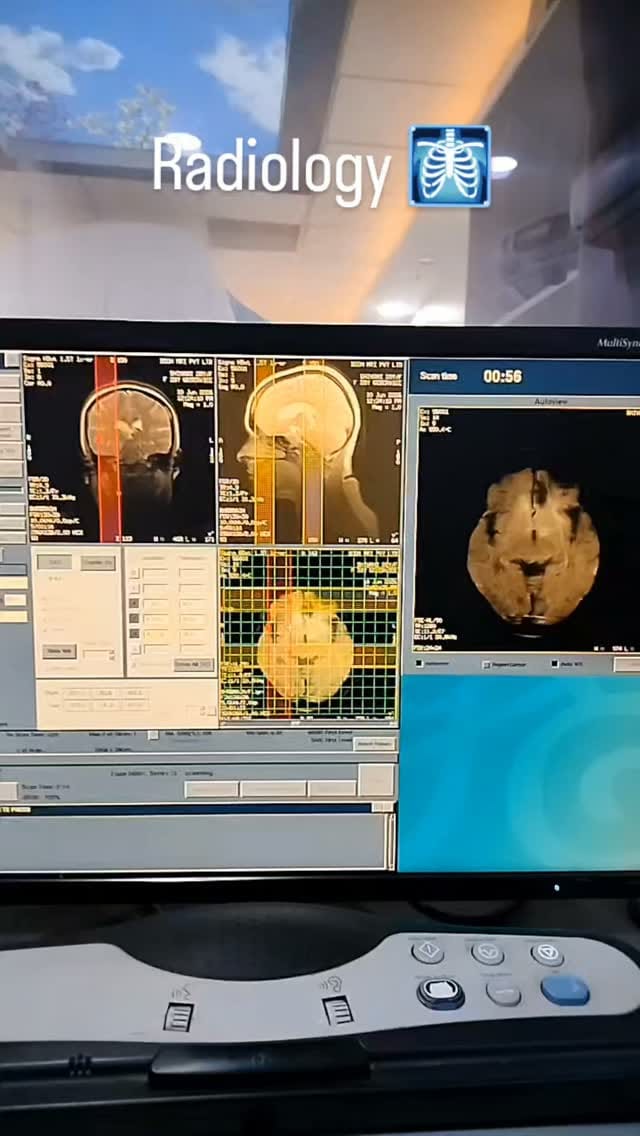 Post 5 by Radiologyyy on Instagram (video)